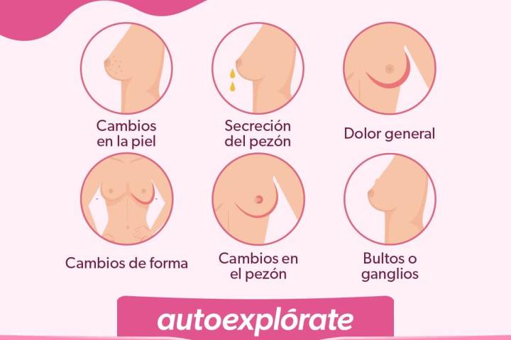 En 2024 SSM detectó 380 nuevos casos nuevos de cáncer de mama