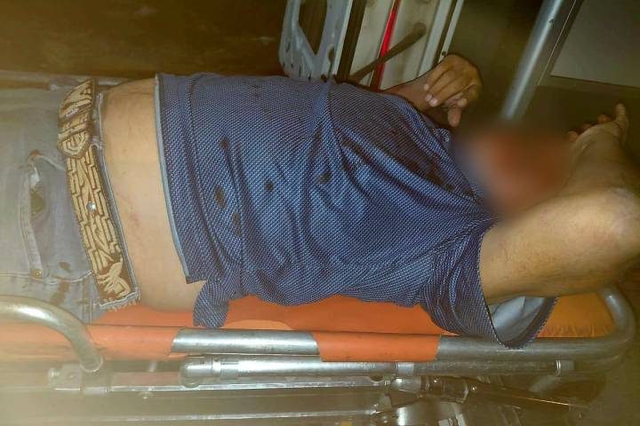 Motociclista resulta gravemente lesionado tras derrape en Apatzingán