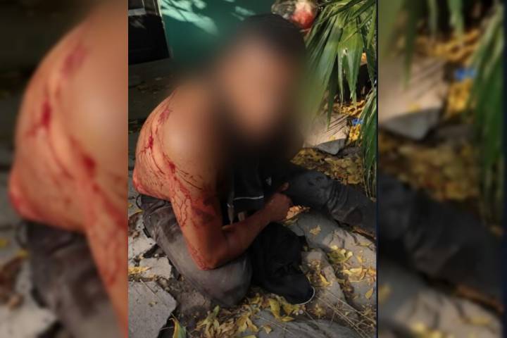 Hieren de 5 balazos a "El Chino", en la colonia Vista Hermosa de Apatzingán